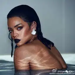 欧阳娜娜硬凹高级感老10岁发际线到头顶,她是不是得了脱发症