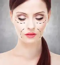 王岳伦为新片选角不要整容脸整容后遗症曝光令人咋舌