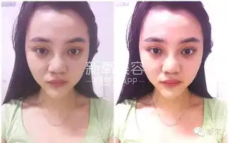 被删重发这个姑娘的整形急迫指数爆表了