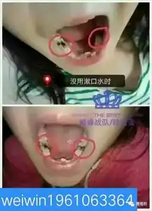 华北珍氏美漱口水全国火热招商,带你月入五位数