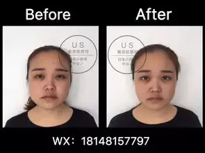 城南帅哥医师火了竟然是来自日本的禁欲系男神