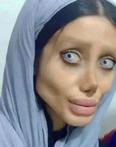 女子想整成性感美女安吉丽娜,结果整完变丧尸