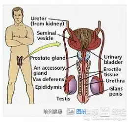 前列腺癌晚期死亡率高吗