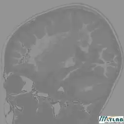 如何将图像的灰色部分背景变为白色呀