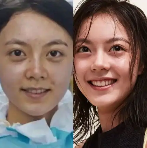 在一起女演员无滤镜,赵今麦认不出来,阚清子孙俪状态好