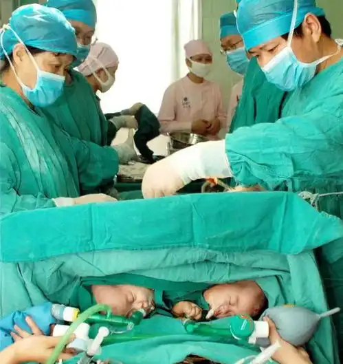 我国首例坐骨连体双胞胎,当初男女不分,15年后,令人感慨