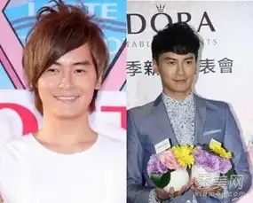 男星整容失败案例图揭炎亚纶郑元畅容貌变化