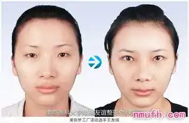 玻尿酸丰耳垂对比图