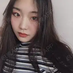 还是喜欢我这个条纹的衣服,感觉挺韩系少女的,最近有...注射除皱悦美整形