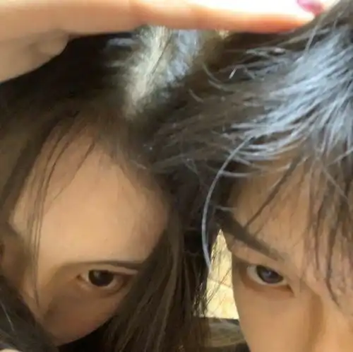 成年人治愈系头像过敏