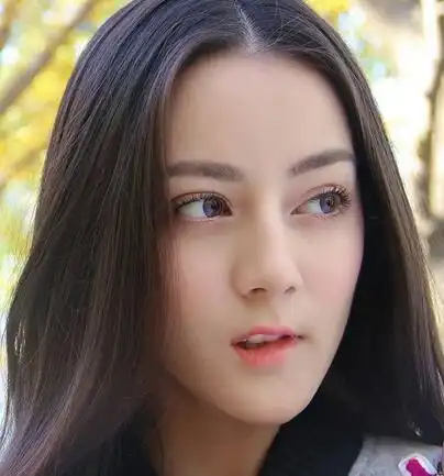 女生去割双眼皮后被嘲讽......是微调还是整容