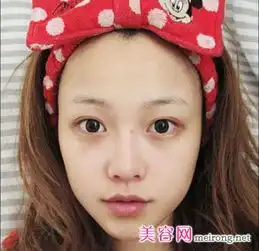 眼部肌肤怎么保养常见的3大眼部保养问题