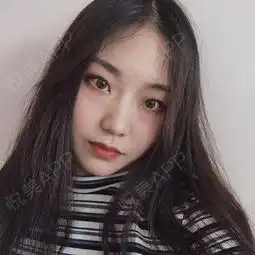 还是喜欢我这个条纹的衣服,感觉挺韩系少女的,最近有...注射除皱悦美整形