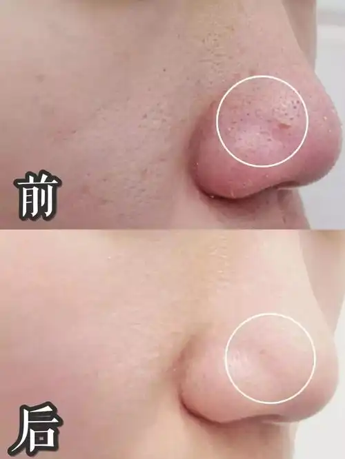 被低估系列我们都欠这位明星人妻一个素颜女神称号包文婧