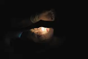 女子整容变毁容患抑郁症鼻子畸形嘴唇不对称