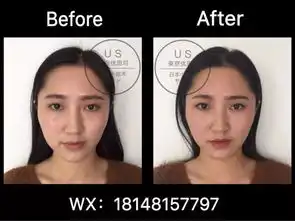 城南帅哥医师火了竟然是来自日本的禁欲系男神