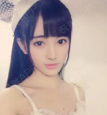 原来眼睑下至术等于猫系犬系无辜感圆眼