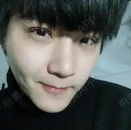 哈喽大家好啊,这两天的阳光好暖啊,懒惰大叔我都出来...眼综合悦美整形